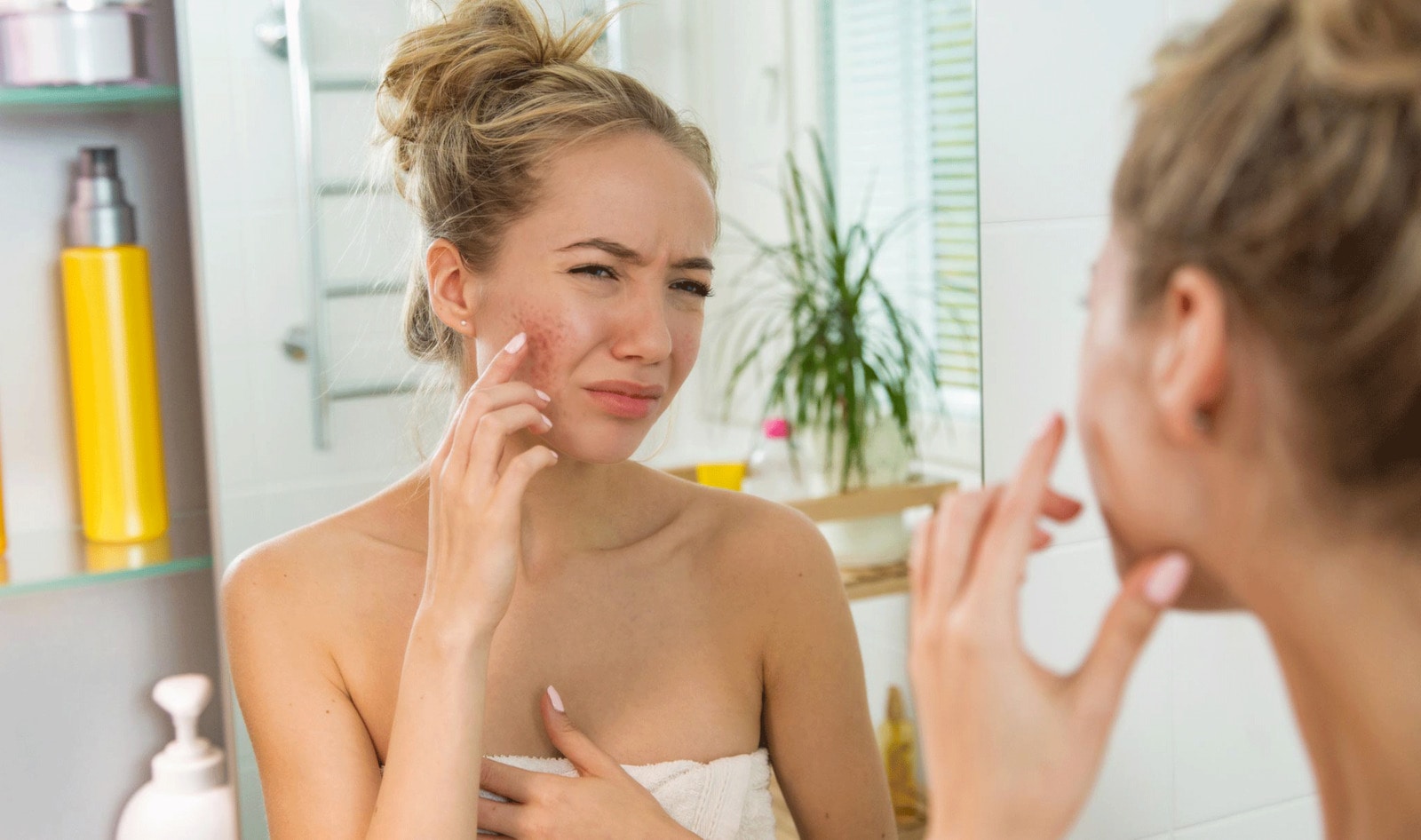 Man Proves Dairy Leads to Acne by “Spiking” Vegan Girlfriend’s Creamer