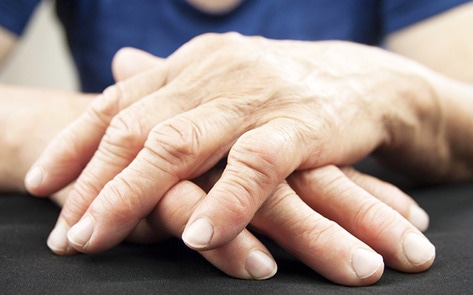 Milk and Meat Bacteria Linked to Rheumatoid Arthritis