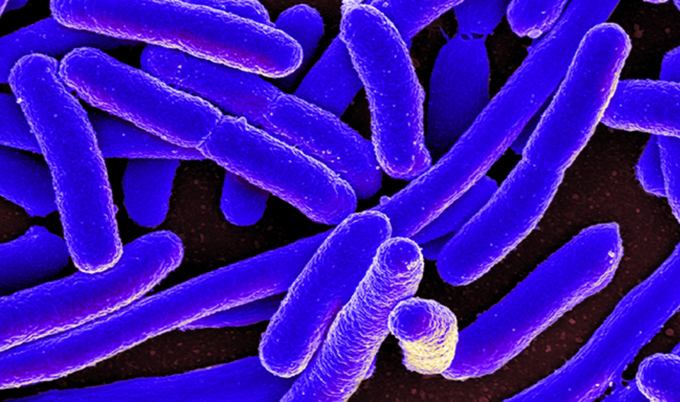 Superbug Found in 80 Percent of Supermarket Meat