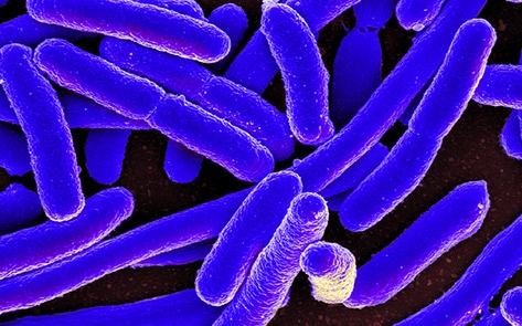 Superbug Found in 80 Percent of Supermarket Meat