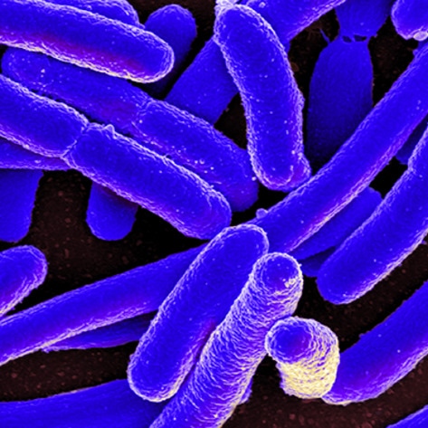 Superbug Found in 80 Percent of Supermarket Meat