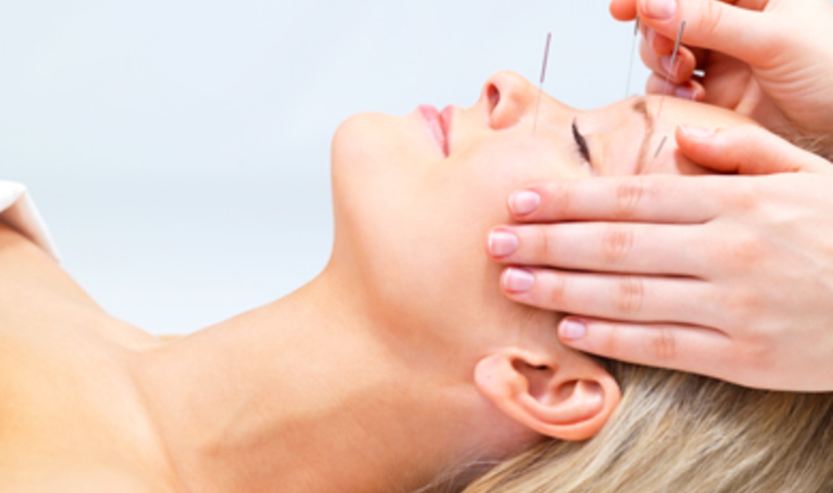 5 Tips for Choosing the Right Acupuncturist VegNews