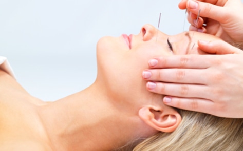 5 Tips for Choosing the Right Acupuncturist