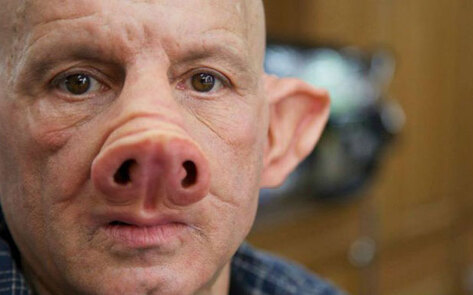 NIH Considering Human-Animal Stem Cell Research