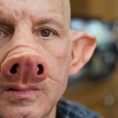 NIH Considering Human-Animal Stem Cell Research