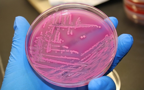 Animal Agriculture Makes Planet "Infect-able"