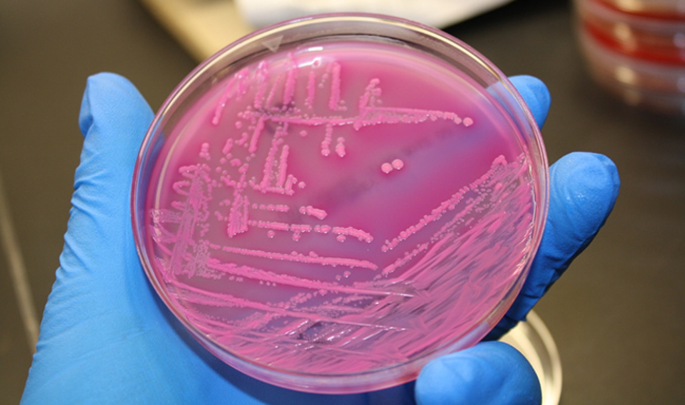Animal Agriculture Makes Planet "Infect-able"